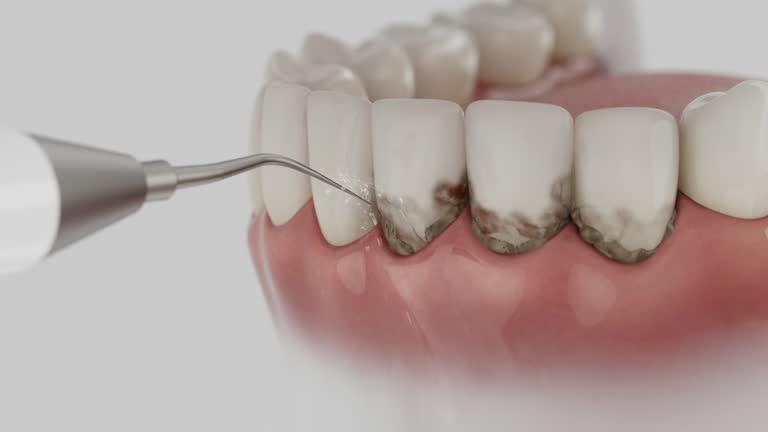 Reliable Emergency Dentist contractor in Strafford, MO by Smile Center Dentistry